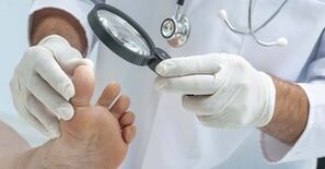 Doctorul examinează piciorul afectat de ciupercă